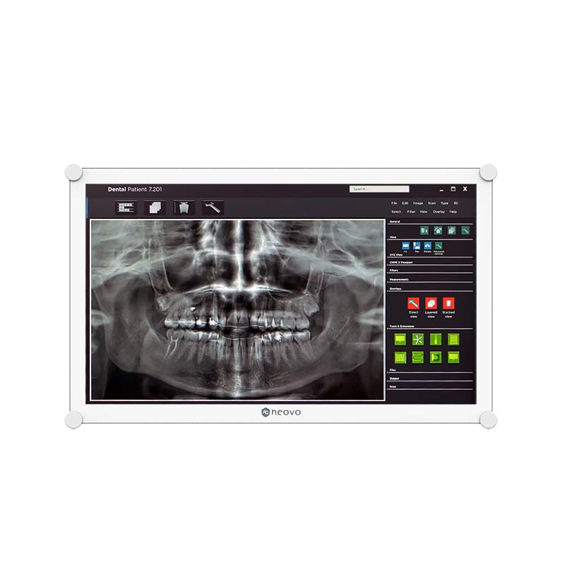 AG Neovo DR-2202 medizinischer Monitor 55,9 cm (22")